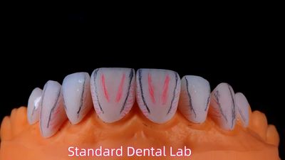 Standard Dental Lab Co., Limited línea de producción del fabricante