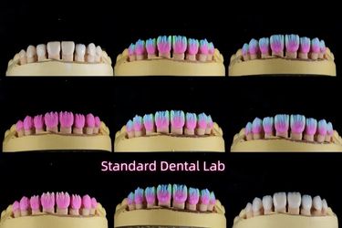 Standard Dental Lab Co., Limited línea de producción del fabricante