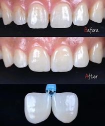 Standard Dental Lab Co., Limited línea de producción del fabricante