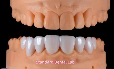 Standard Dental Lab Co., Limited línea de producción del fabricante