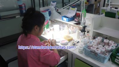 Standard Dental Lab Co., Limited línea de producción del fabricante