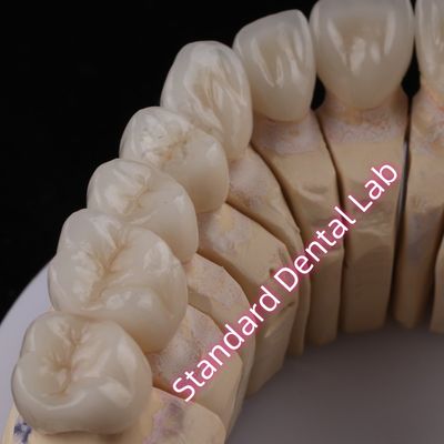 comprar Digital CAD CAM Dental Lab PFZ Coronas translúcidas de zirconia en capas fabricación en línea