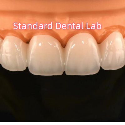 comprar Laboratorio dental con coronas de zirconia y puente con porcelana en capas fabricación en línea