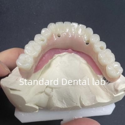 comprar Restauración estética Todos en 4 implantes dentales Circonia Hipoalergénico fabricación en línea