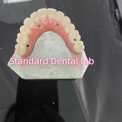 comprar Todo en cuatro seis Ivoclar Zirconia Implante Puente Titanio Bar con goma rosa de porcelana fabricación en línea