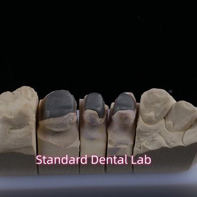 comprar Métalo fundido post Core Corona Cocr Retención exacta completa Zirconia Bruxier fabricación en línea