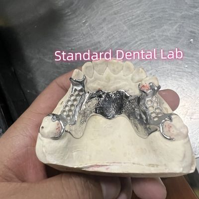 comprar Cuadro fundido de cobalto cromo Dentadura parcial Vitallium 2000 fabricación en línea