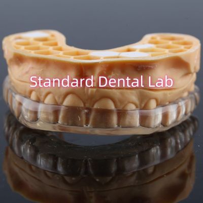 comprar Protector dental profesional personalizado contra el ronquido Protector bucal nocturno mejorado para rechinar dientes fabricación en línea