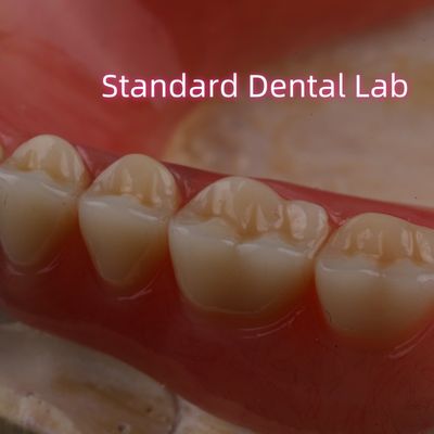 comprar SDL Dentadura parcial acrílica curada térmicamente Dentes Ivoclares Laboratorio Dental Alta precisión fabricación en línea