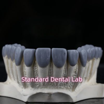 comprar Estándar de laboratorio dental de la corona dental de cera alta estética fabricación en línea