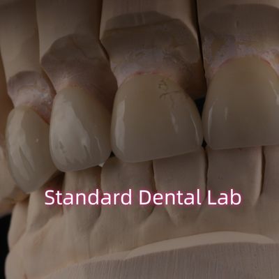 comprar Laboratorio Dental Profesional Corona de zirconia para restauración fija fabricación en línea