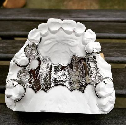comprar Cuadro de dentadura parcial extraíble de cobalto cromo Impresión láser Ni Be gratis fabricación en línea