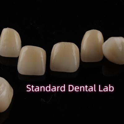 comprar Coronas dentales de zirconia de capas fuertes Restauración completa del arco superior fabricación en línea