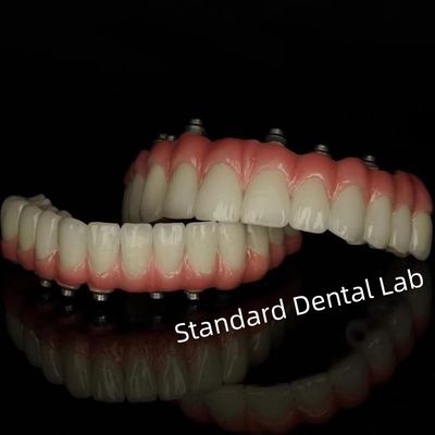 comprar Implante de cemento de tornillo Restauración dental retenida del laboratorio dental estándar fabricación en línea