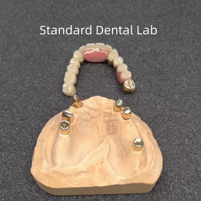 comprar CAD CAM Dente Dentadura parcial Apego Dental Profesional Específico fabricación en línea
