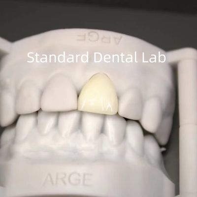 comprar Coronas digitales de laboratorio dental CAD CAM de zirconía translúcida en capas fabricación en línea