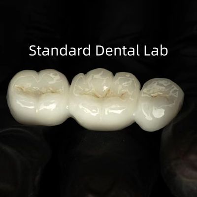 comprar Circónia sólida de alto translucidez de contorno completo fabricación en línea