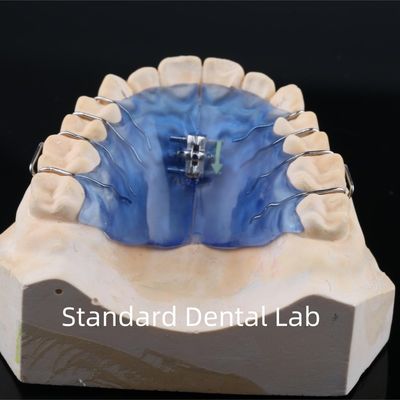 comprar Expansión del paladar de los dientes con tornillo removible fabricación en línea
