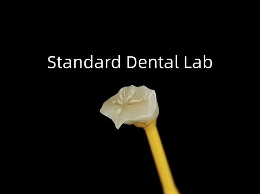 comprar Enlaces de porcelana dental Enlaces de zirconia Emax Alta estética fabricación en línea
