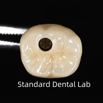 comprar Coroa de implante dental con tornillo retenido fabricación en línea