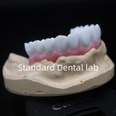 comprar Alta estética corona dental blanca de diagnóstico de cera personalizada China laboratorio dental fabricación en línea