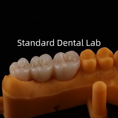 comprar Coronas de porcelana de metal Be Ni Precise Estética PFM Coronas dentales fabricación en línea