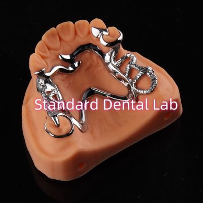 comprar Cobalt Chrome Framework Ni Be Free prótesis dental extraíble China Laboratorio Dental fabricación en línea