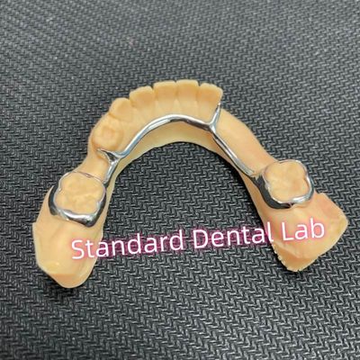 comprar Mantenedor de espacio bilateral dental para dientes perdidos Arco de retención de la lengua fabricación en línea