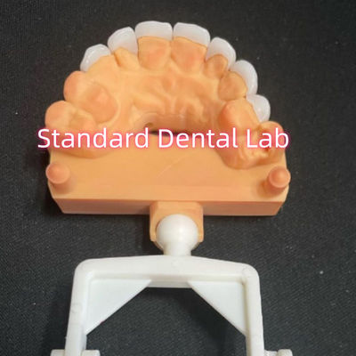 comprar Laminado de aspecto natural Zirconia Emax Veneers espesor 0,6 mm fabricación en línea