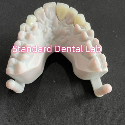 comprar Dientes dentales de la sonrisa de las estrellas Emax Zirconia carillas laminadas 0.6mm fabricación en línea