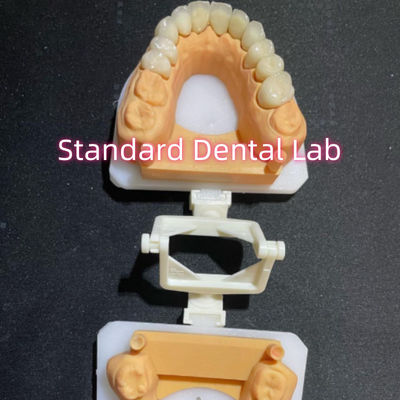 comprar Dentista Restaurador Odontología Cuidado Oral Corona completa de zirconia personalizada fabricación en línea