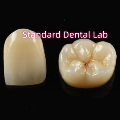 comprar Material biocompatible Estética corona de zirconio zirconio puente de dientes fabricación en línea
