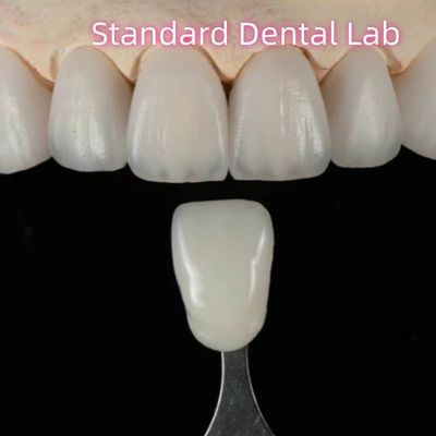 comprar Puente dental de zirconia de ayuda natural de alta estética personalizada fabricación en línea