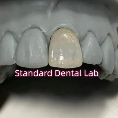 comprar Dentistería restaurativa Emax Coronas dentales de porcelana de zirconia fabricación en línea