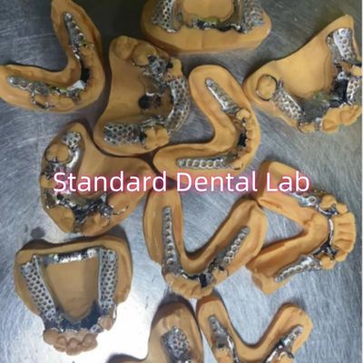 comprar Cuadro metálico fundido de cobalto cromo extraíble Dentes parciales fabricación en línea