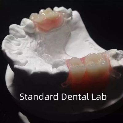 comprar Flexible marco de metal fundido transparente dentaduras parciales alta estética ajuste perfecto fabricación en línea