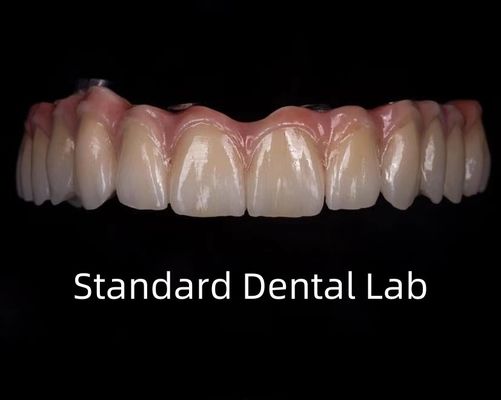 comprar Translucidez dental de puente de zirconio de titanio completo en barra de implantes fabricación en línea