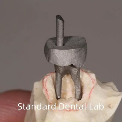 comprar Restauración dental post de metal y corona de núcleo perfecto ajuste fabricación en línea