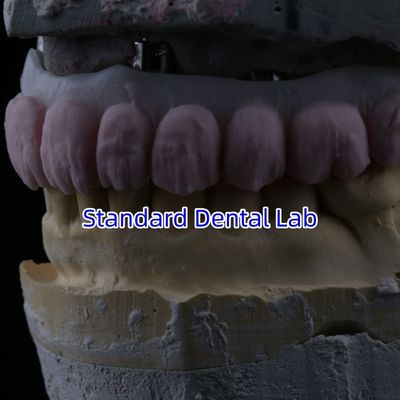 comprar Porcelana todo en cuatro puente de zircónía alta estética puente de implantes dentales fabricación en línea