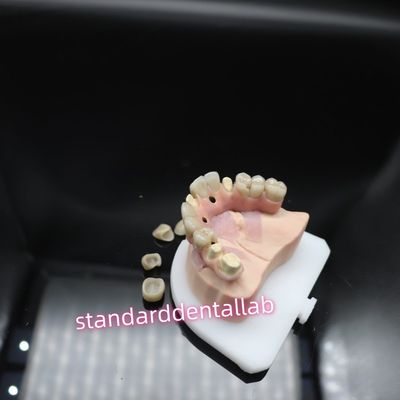 comprar Puente de implantes dentales digitales de titanio Ivoclar Hybrid Puente de zirconia fabricación en línea