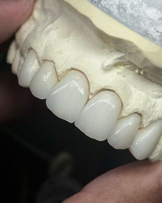 comprar Corona de zirconia de capas de translucidez para una funcionalidad óptima y una estética natural fabricación en línea