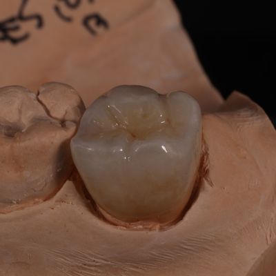 comprar Corona de zirconia translúcida de contorno completo para resultados estéticos fabricación en línea
