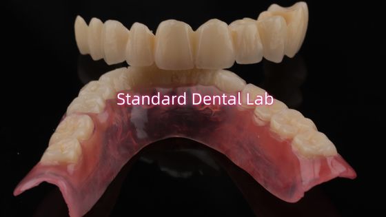 comprar Porcelana en capas muy duradera y de aspecto natural para la cirugía dental en capas Corona de zirconia China Dental Lab fabricación en línea
