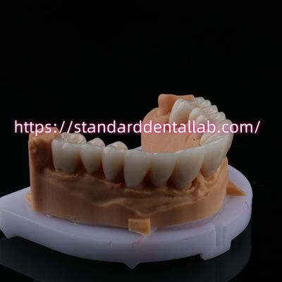 comprar FDA Alta estética Dental Zirconia Puente con corona dental de zirconia de porcelana en capas China Laboratorio Dental fabricación en línea