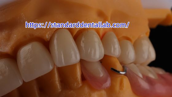 comprar Coroa dental de zircón en capas y puente Translucidez 3D PRO corona de porcelana de zircón fabricación en línea
