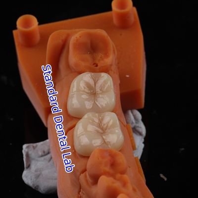 comprar Coroneta de zirconio de contorno completo translúcido 3D PRO sin recubrimiento de porcelana Laboratorio dental estándar fabricación en línea