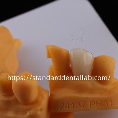 comprar Coronas de laboratorio dentales de contorno completo de alta translucidez Coronas sólidas de zirconia de laboratorio dental chino fabricación en línea