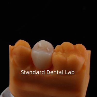 comprar Coronilla de zirconio de contorno completo Fuerza y estética excepcionales Sin recubrimiento de porcelana Coronilla posterior Laboratorio dental de China fabricación en línea
