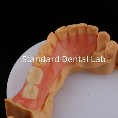 comprar Dientes de Ace Rosa/Oscuro TCS Valplast Dentaduras parciales flexibles para alta estética Modelo de impresión 3D dental fabricación en línea