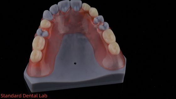 comprar Modelo de impresión en 3D Alta estética Dental TCS Valplast Flexible Dentes parciales Dental Laboratorio fabricación en línea